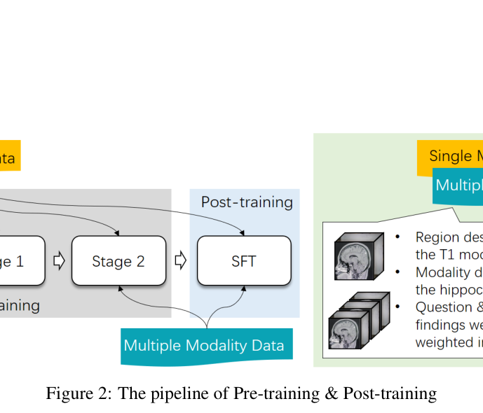 Figure 2: The pipeline of Pre-training & Post-training