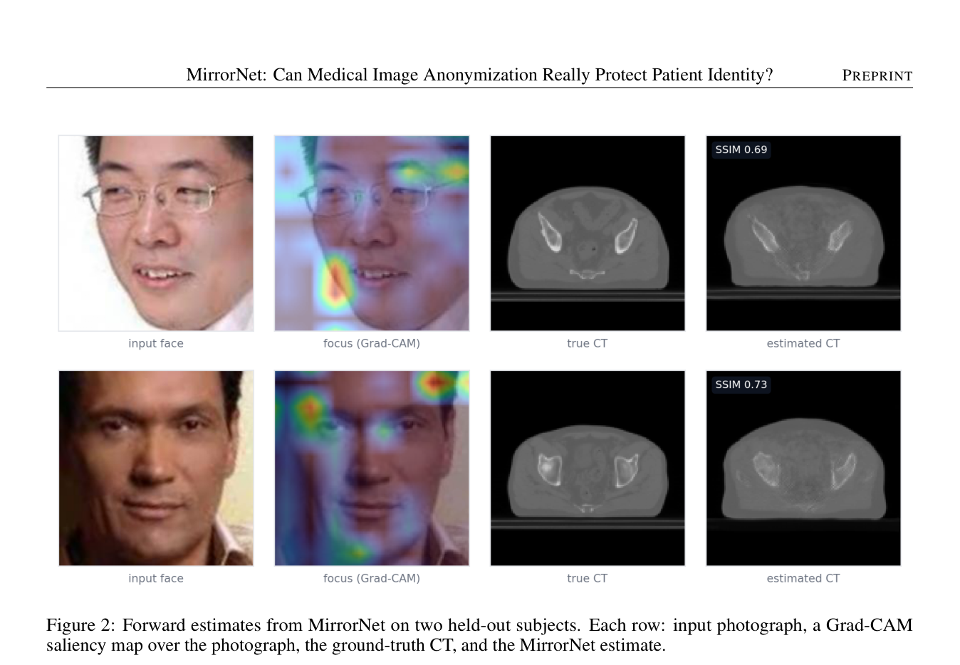 Figure 2: Forward estimates from MirrorNet on two held-out subjects