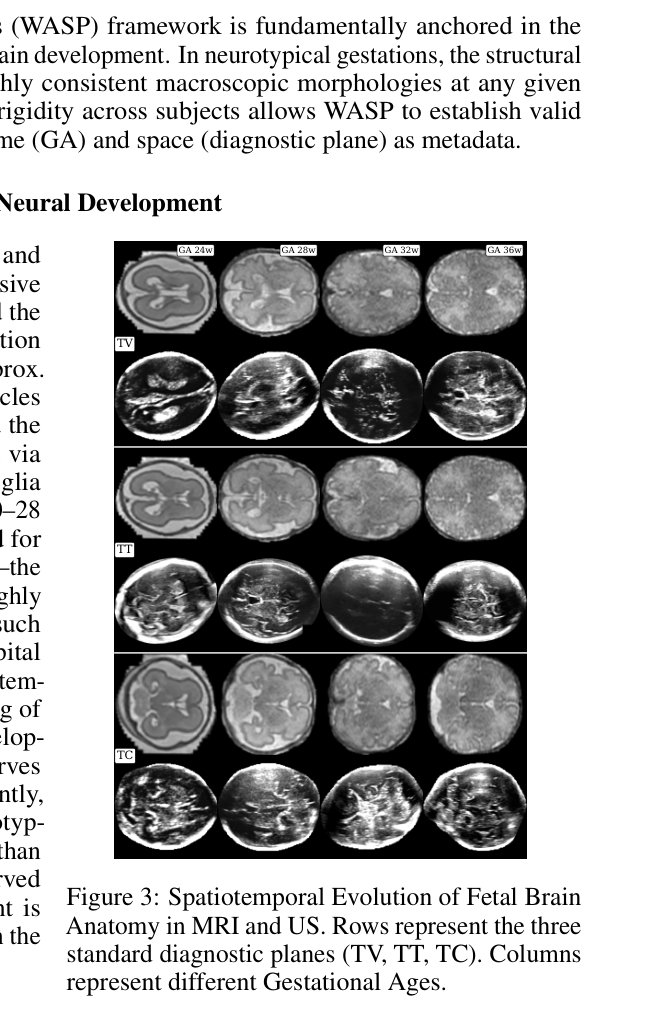 Figure 3: Spatiotemporal Evolution of Fetal Brain Anatomy in MRI and US